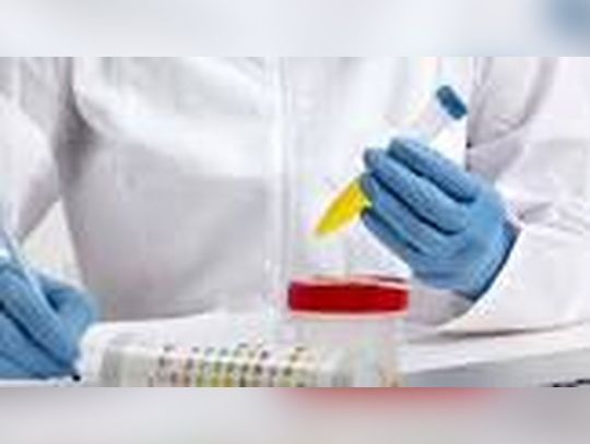 Why Only Athletes Get Drug Tested