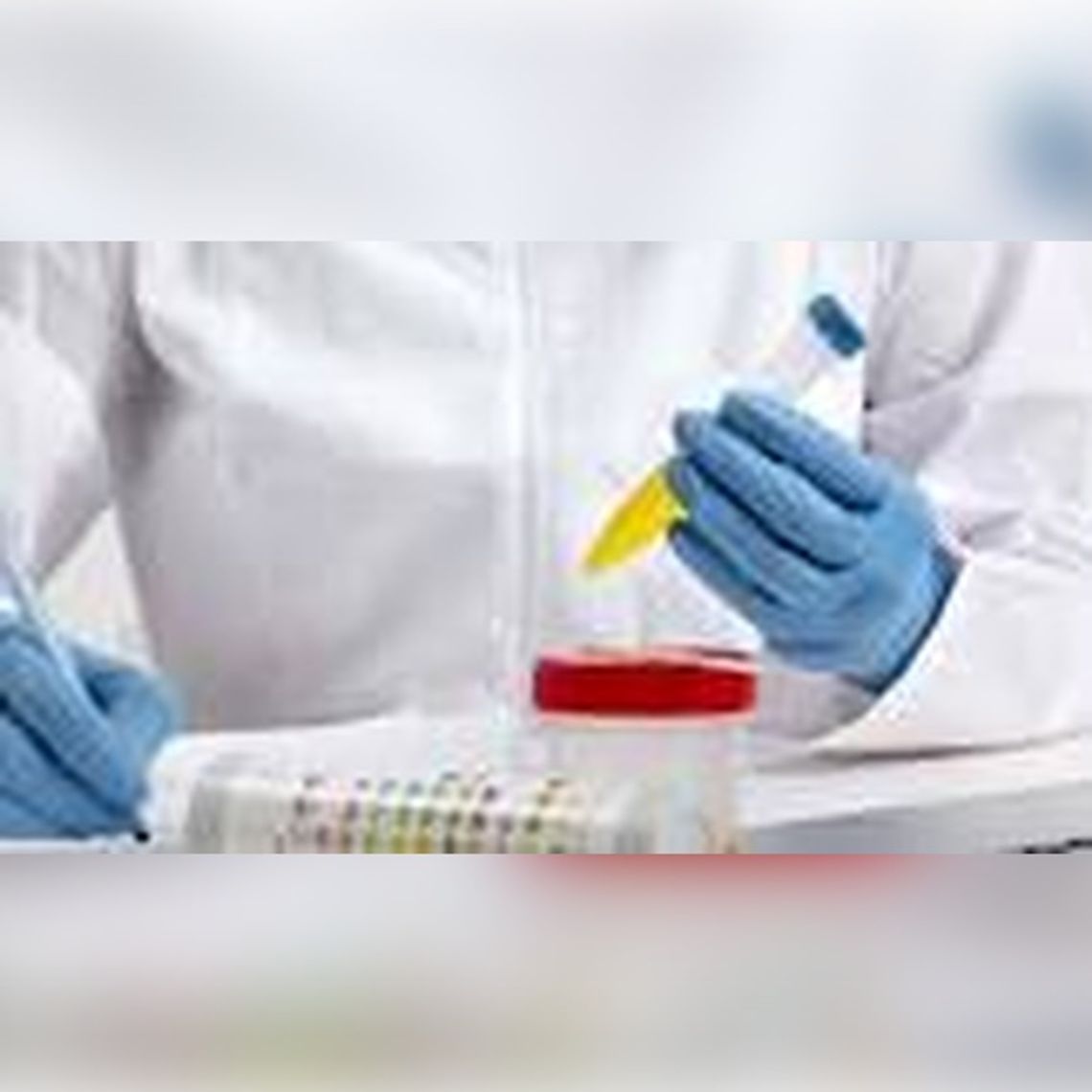 Why Only Athletes Get Drug Tested Why Only Athletes Get Drug Tested